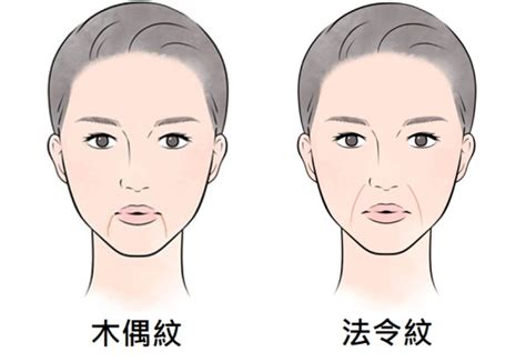 法令紋 木偶紋|出現木偶紋、法令紋怎麼辦？臉部產生紋路原因有哪些？5方法預。